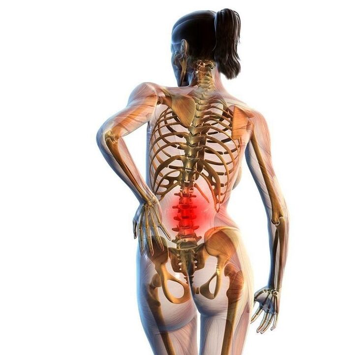 Lumbar mina