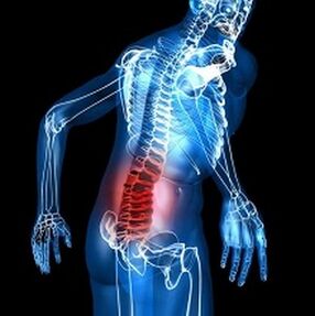 Osteokondrosia