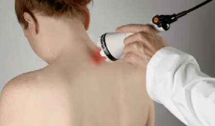 Lepoko osteokondrosiaren tratamendua fisioterapia metodoak erabiliz