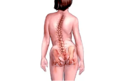 Trápaga osteokondrosia garatzeko arrazoiak