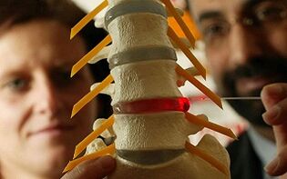 Bizkarrezurraren torakoaren osteokondrosiaren sintomak eta tratamendua
